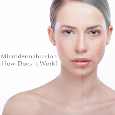 how does microdermabrasion work